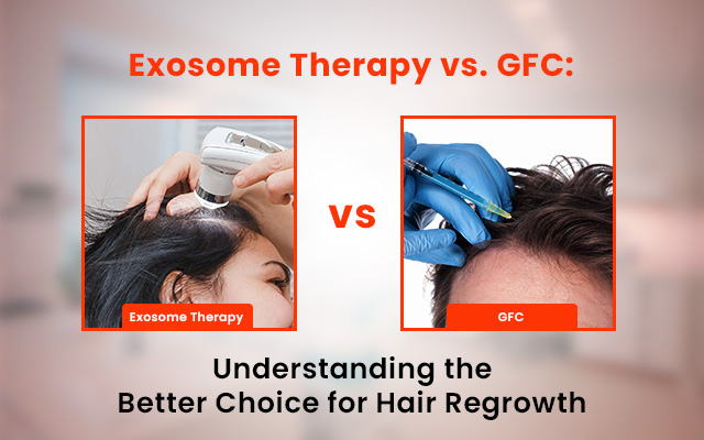 Exosome Therapy vs. GFC: Understanding the Better Choice for Hair Regrowth