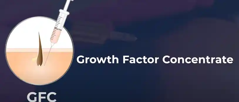 Benefits of GFC Therapy: