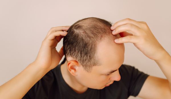 who needs the treatment