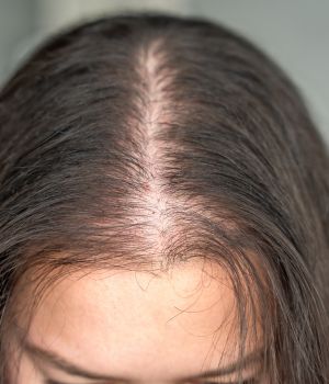 who needs the treatment