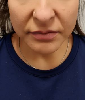 who needs the treatment