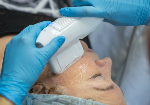 HIFU Skin Tightening