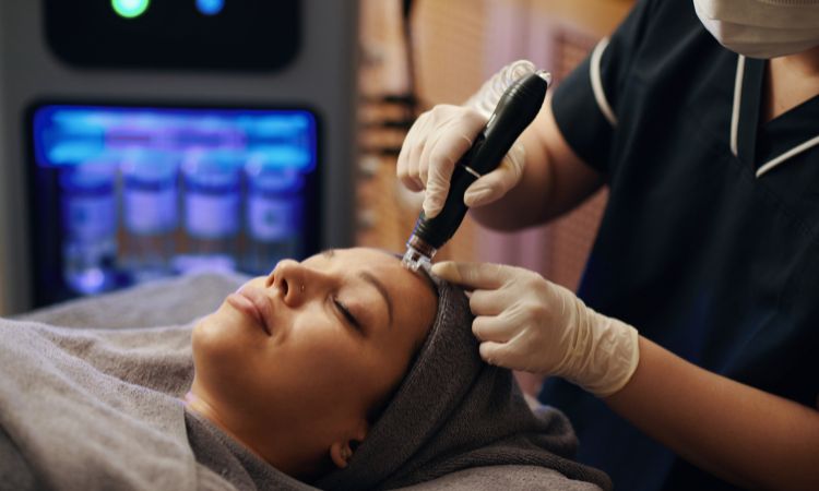 Microneedling Treatment