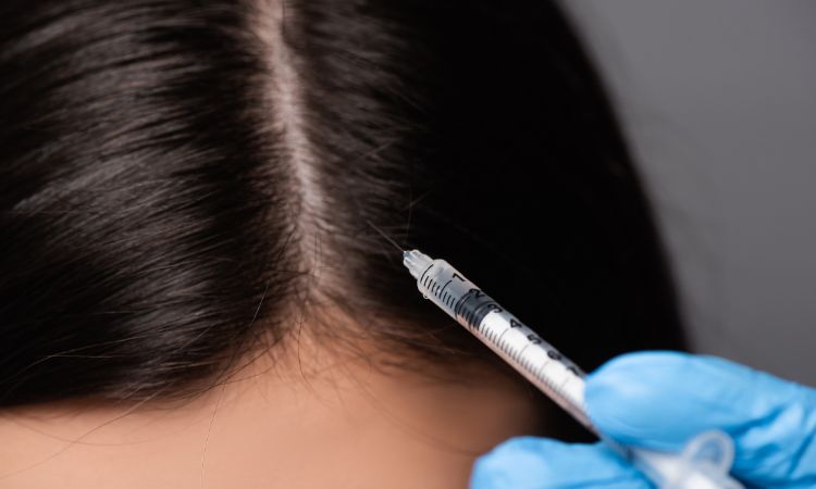 PRP Hair Loss Treatment