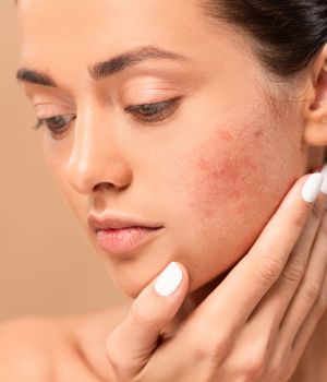 who needs the treatment