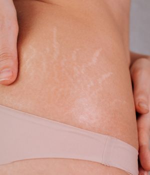 who needs the treatment