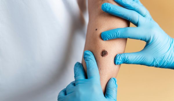 who needs the treatment