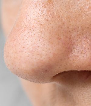 who needs the treatment