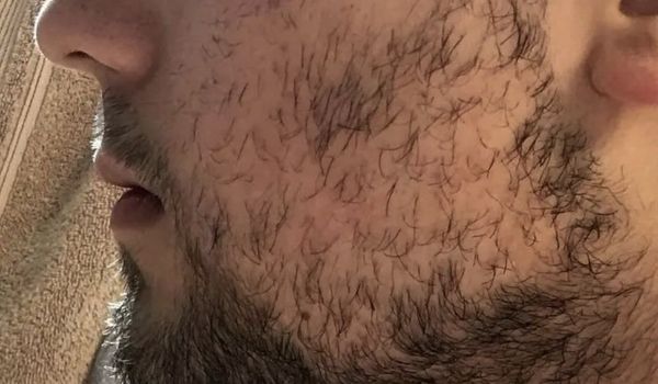 who needs the treatment