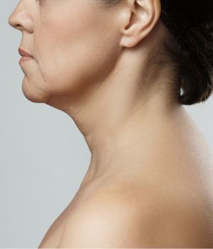 who needs the treatment