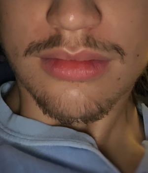 who needs the treatment