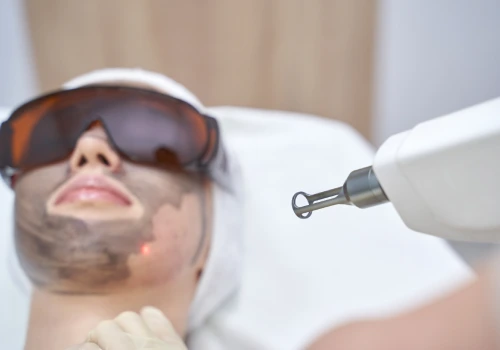 CO2 Laser Treatment in Kolkata |  Elation Skin & Hair