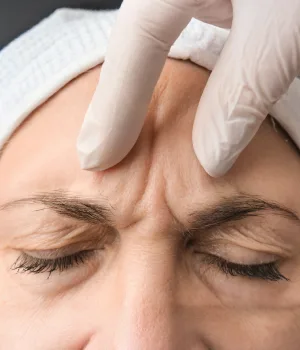 Morpheus Treatment in Kolkata | Elation Skin & Hair