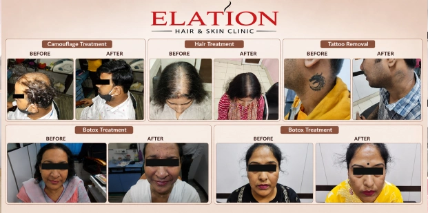 Before & After