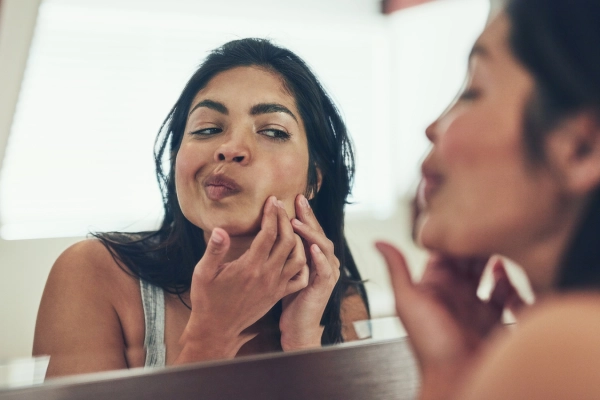 Acne and Acne Scar Treatment at Ultadanga Acne and Acne Scar Treatment at Ultadanga