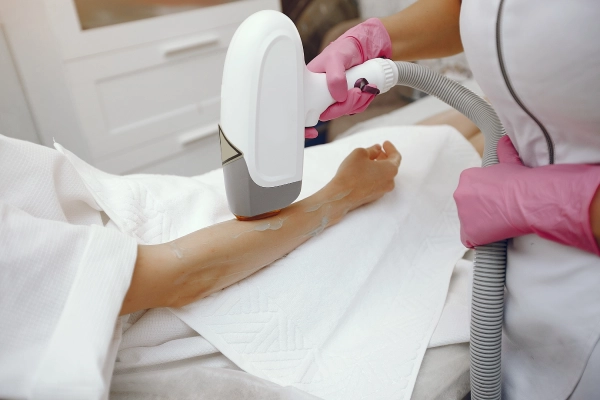 Laser Hair Removal at Ultadanga Laser Hair Removal at Ultadanga